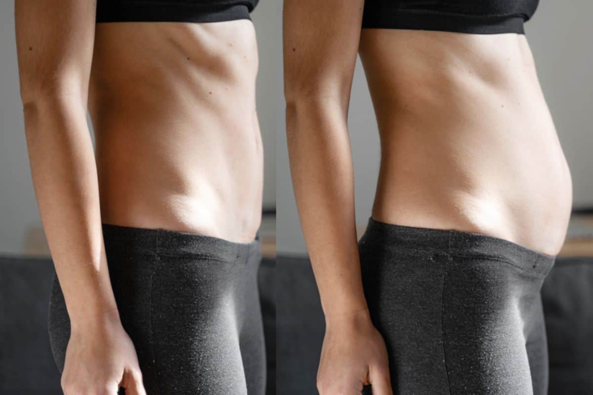 How long does diastasis recti take to improve Andover?