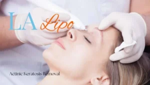 Woman receiving Actinic Keratosis Removal Treatment Andover
