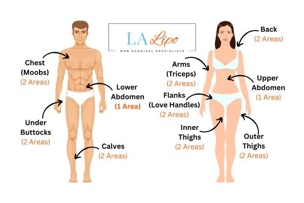 LA LIPO Cryolipolysis Areas Andover