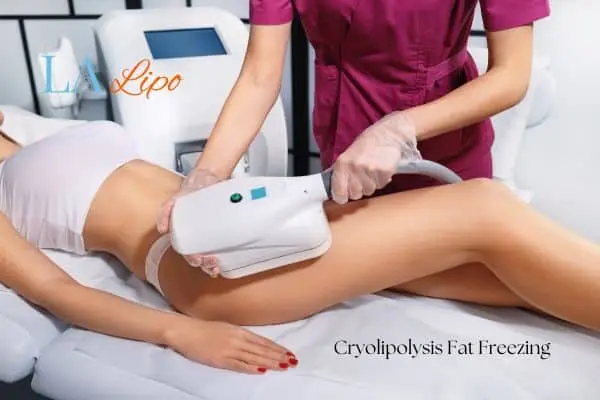 Woman receiving coolsculpting Andover treatment on her thighs