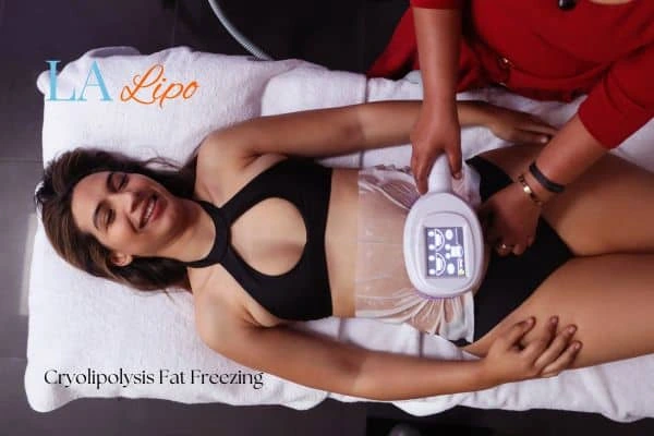 woman getting cryolipolysis Andover