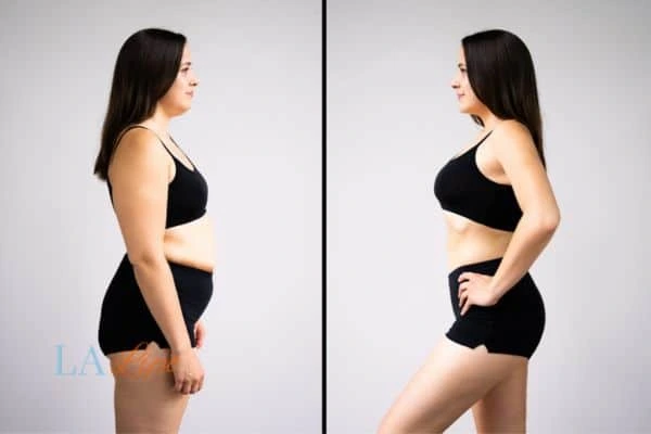 Picture of womans before and after using LA-EMS body sculpting to improve her core strength Andover