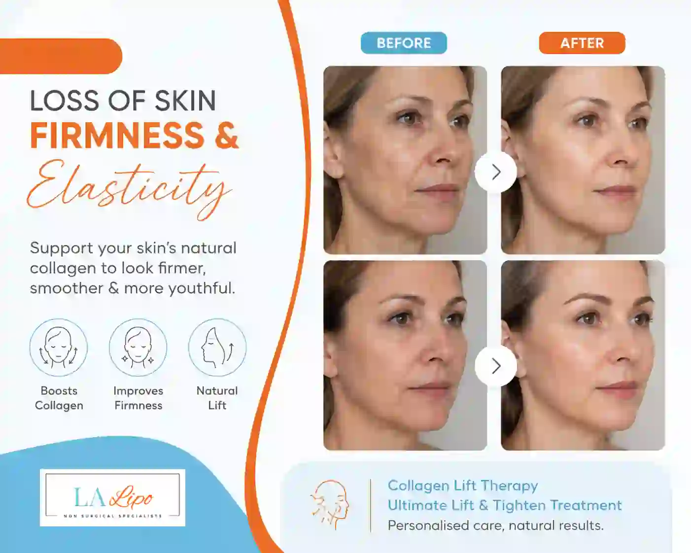 Sign #7: Loss of Skin Firmness and Elasticity Andover